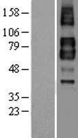 TGFBR2 Protein - Western validation with an anti-DDK antibody * L: Control HEK293 lysate R: Over-expression lysate