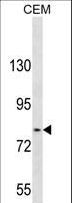 TGFBRAP1 / TRAP-1 Antibody - TGFBRAP1 Antibody western blot of CEM cell line lysates (35 ug/lane). The TGFBRAP1 antibody detected the TGFBRAP1 protein (arrow).