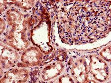 TGFBRAP1 / TRAP-1 Antibody - Immunohistochemistry of paraffin-embedded human kidney tissue using TGFBRAP1 Antibody at dilution of 1:100