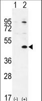 TGIF1 Antibody - Western blot of TGIF1 (arrow) using rabbit polyclonal TGIF1 Antibody (Center L223). 293 cell lysates (2 ug/lane) either nontransfected (Lane 1) or transiently transfected (Lane 2) with the TGIF1 gene.