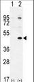 TGIF1 Antibody - Western blot of TGIF1 (arrow) using rabbit polyclonal TGIF1 Antibody (Center L223). 293 cell lysates (2 ug/lane) either nontransfected (Lane 1) or transiently transfected (Lane 2) with the TGIF1 gene.