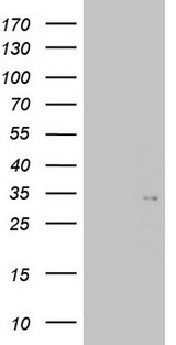 TGIF1 Antibody - HEK293T cells were transfected with the pCMV6-ENTRY control (Left lane) or pCMV6-ENTRY TGIF1 (Right lane) cDNA for 48 hrs and lysed. Equivalent amounts of cell lysates (5 ug per lane) were separated by SDS-PAGE and immunoblotted with anti-TGIF1.