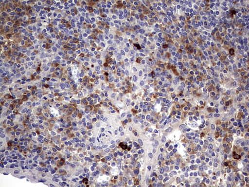 TGIF1 Antibody - IHC of paraffin-embedded Human tonsil using anti-TGIF1 mouse monoclonal antibody. (Heat-induced epitope retrieval by 1 mM EDTA in 10mM Tris, pH8.5, 120°C for 3min).