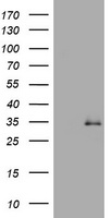 TGIF1 Antibody - HEK293T cells were transfected with the pCMV6-ENTRY control (Left lane) or pCMV6-ENTRY TGIF1 (Right lane) cDNA for 48 hrs and lysed. Equivalent amounts of cell lysates (5 ug per lane) were separated by SDS-PAGE and immunoblotted with anti-TGIF1.