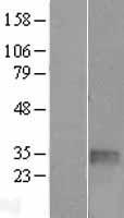 TGIF1 Protein - Western validation with an anti-DDK antibody * L: Control HEK293 lysate R: Over-expression lysate