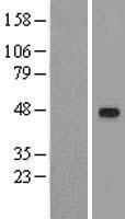 TGIF1 Protein - Western validation with an anti-DDK antibody * L: Control HEK293 lysate R: Over-expression lysate