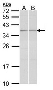 TGIF2 Antibody - Sample (30 ug of whole cell lysate). A: A431 , B: Hela. 12% SDS PAGE. TGIF2 antibody diluted at 1:1000.