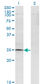 TGIF2 Antibody - Western blot of TGIF2 expression in transfected 293T cell line by TGIF2 monoclonal antibody (M15), clone 2A4.