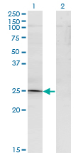TGIF2 Antibody - Western blot of TGIF2 expression in transfected 293T cell line by TGIF2 monoclonal antibody (M15), clone 2A4.