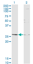 TGIF2 Antibody - Western blot of TGIF2 expression in transfected 293T cell line by TGIF2 monoclonal antibody (M16), clone 2D4.