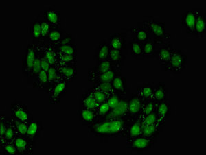 TGIF2 Antibody - Immunofluorescent analysis of HepG2 cells at a dilution of 1:100 and Alexa Fluor 488-congugated AffiniPure Goat Anti-Rabbit IgG(H+L)