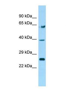 TGIF2 Antibody - Western blot of Rat Heart. Tgif2 antibody dilution 1.0 ug/ml.  This image was taken for the unconjugated form of this product. Other forms have not been tested.