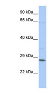 TGIF2LX Antibody - TGIF2LX antibody Western blot of Jurkat lysate. This image was taken for the unconjugated form of this product. Other forms have not been tested.