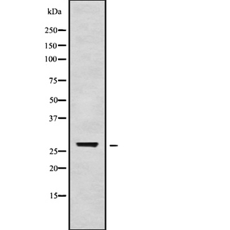 TGIF2LX Antibody - Western blot analysis of TGIF2LX using HepG2 whole cells lysates