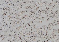 TGIF2LX Antibody - 1:100 staining human lung tissue by IHC-P. The sample was formaldehyde fixed and a heat mediated antigen retrieval step in citrate buffer was performed. The sample was then blocked and incubated with the antibody for 1.5 hours at 22°C. An HRP conjugated goat anti-rabbit antibody was used as the secondary.