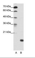 TGIF2LY Antibody - A: Marker, B: HepG2 Cell Lysate.  This image was taken for the unconjugated form of this product. Other forms have not been tested.