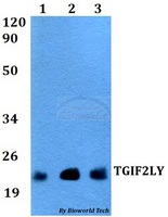 TGIF2LY Antibody - Western blot of TGIF2LY antibody at 1:500 dilution. Lane 1: MCF-7 whole cell lysate. Lane 2: Jurkat whole cell lysate. Lane 3: PC12 whole cell lysate.