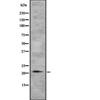 TGIF2LY Antibody - Western blot analysis of TGIF2LY using NIH-3T3 whole cells lysates