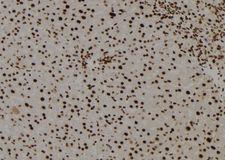 TGIF2LY Antibody - 1:100 staining mouse liver tissue by IHC-P. The sample was formaldehyde fixed and a heat mediated antigen retrieval step in citrate buffer was performed. The sample was then blocked and incubated with the antibody for 1.5 hours at 22°C. An HRP conjugated goat anti-rabbit antibody was used as the secondary.