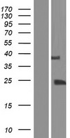 TGIF2LY Protein - Western validation with an anti-DDK antibody * L: Control HEK293 lysate R: Over-expression lysate