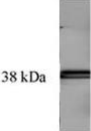 TGM / Transglutaminase Antibody - Immunoblotting: use at 1-10ug/ml. A band of ~38kDa is detected.