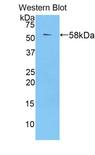 TGM1 / Transglutaminase Antibody - Western blot of recombinant TGM1 / Transglutaminase.  This image was taken for the unconjugated form of this product. Other forms have not been tested.