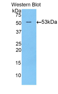 TGM1 / Transglutaminase Antibody - Western blot of recombinant TGM1 / Transglutaminase.  This image was taken for the unconjugated form of this product. Other forms have not been tested.