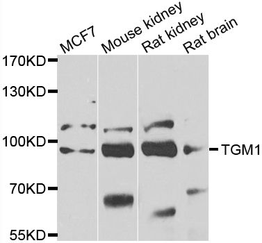 TGM1 / Transglutaminase Antibody - Western blot analysis of extracts of various cell lines, using TGM1 antibody at 1:1000 dilution. The secondary antibody used was an HRP Goat Anti-Rabbit IgG (H+L) at 1:10000 dilution. Lysates were loaded 25ug per lane and 3% nonfat dry milk in TBST was used for blocking. An ECL Kit was used for detection and the exposure time was 90s.