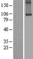 TGM1 / Transglutaminase Protein - Western validation with an anti-DDK antibody * L: Control HEK293 lysate R: Over-expression lysate