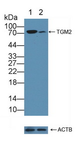 TGM2 / Transglutaminase 2 Antibody - Knockout Varification: Lane 1: Wild-type Hela cell lysate; Lane 2: TGM2 knockout Hela cell lysate; Predicted MW: 77kd Observed MW: 77kd Primary Ab: 1µg/ml Rabbit Anti-Human TGM2 Antibody Second Ab: 0.2µg/mL HRP-Linked Caprine Anti-Rabbit IgG Polyclonal Antibody