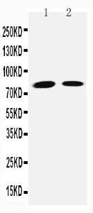 TGM2 / Transglutaminase 2 Antibody - WB of TGM2 / Transglutaminase 2 antibody. Lane 1: JURKAT Cell Lysate. Lane 2: HELA Cell Lysate.