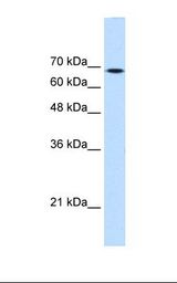 TGM2 / Transglutaminase 2 Antibody - HepG2 cell lysate. Antibody concentration: 0.25 ug/ml. Gel concentration: 12%.  This image was taken for the unconjugated form of this product. Other forms have not been tested.