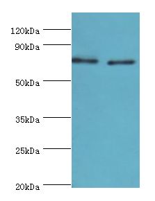TGM2 / Transglutaminase 2 Antibody - Western blot. All lanes: Protein-glutamine gamma-glutamyltransferase 2 antibody at 8 ug/ml. Lane 1: HeLa whole cell lysate. Lane 2: HepG2 whole cell lysate. secondary Goat polyclonal to rabbit at 1:10000 dilution. Predicted band size: 77 kDa. Observed band size: 77 kDa.