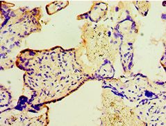 TGM2 / Transglutaminase 2 Antibody - Immunohistochemistry of paraffin-embedded human placenta using antibody at 1:100 dilution.