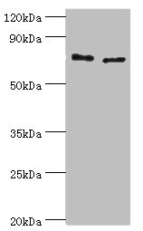 TGM2 / Transglutaminase 2 Antibody - Western blot All lanes: Protein-glutamine gamma-glutamyltransferase 2 antibody at 8µg/ml Lane 1: Hela whole cell lysate Lane 2: HepG2 whole cell lysate Secondary Goat polyclonal to rabbit IgG at 1/10000 dilution Predicted band size: 78, 62, 39 kDa Observed band size: 78 kDa