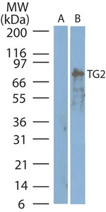 TGM2 / Transglutaminase 2 Antibody - Western blot of Transglutaminase 2inA) MCF-7 negative control cell lysate and B) BxPC-3 cell lysate using Peptide-affinity Purified Polyclonal Antibody to Transglutaminase 2 (TG2) at0.64 ug/ml.