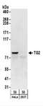 TGM2 / Transglutaminase 2 Antibody - Detection of Human TG2 by Western Blot. Samples: Whole cell lysate (50 ug) from HeLa and 293T cells. Antibodies: Affinity purified rabbit anti-TG2 antibody used for WB at 0.1 ug/ml. Detection: Chemiluminescence with an exposure time of 30 seconds.
