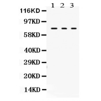 TGM2 / Transglutaminase 2 Antibody - TGM2 antibody Western blot. All lanes: Anti TGM2 at 0.5 ug/ml. Lane 1: Rat Liver Tissue Lysate at 50 ug. Lane 2: Rat Ovary Tissue Lysate at 50 ug. Lane 3: HELA Whole Cell Lysate at 40 ug. Predicted band size: 77 kD. Observed band size: 77 kD.