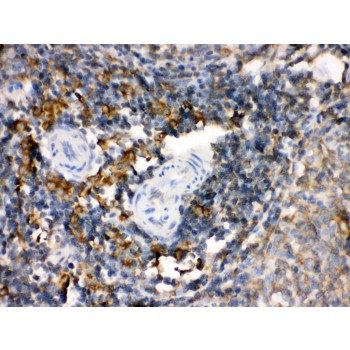 TGM2 / Transglutaminase 2 Antibody - TGM2 antibody IHC-paraffin. IHC(P): Rat Spleen Tissue.