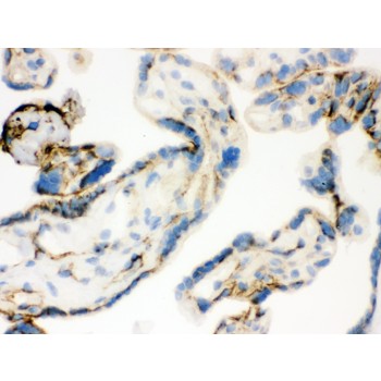 TGM2 / Transglutaminase 2 Antibody - TGM2 antibody IHC-frozen. IHC(F): Human Placenta Tissue.