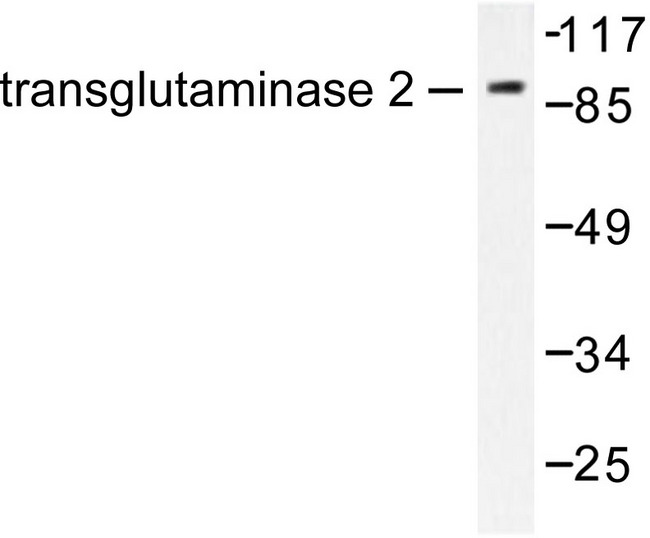 TGM2 / Transglutaminase 2 Antibody - Western blot of Transglutaminase 2 (D11) pAb in extracts from HUVEC cells.
