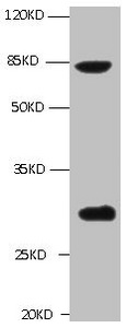 TGM2 / Transglutaminase 2 Antibody - All lanes: Mouse anti-TGM2 Monoclonal antibody at 1ug/ml Lane 1 : A549 whole cell lysate Secondary Goat polyclonal to Mouse IgG at 1/5000 dilution Predicted band size :77kd Observed band size :77,62,39KD Additional bands at :30kd