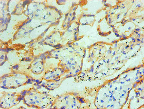 TGM2 / Transglutaminase 2 Antibody - Immunohistochemical of paraffin-embedded Human placenta tissue using TGM2 Monoclonal Antibody at dilution of 1:200.
