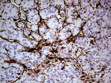 TGM2 / Transglutaminase 2 Antibody - Immunohistochemical staining of paraffin-embedded Human pancreas tissue within the normal limits using anti-TGM2 mouse monoclonal antibody. (Heat-induced epitope retrieval by 1mM EDTA in 10mM Tris buffer. (pH8.5) at 120°C for 3 min. (1:500)