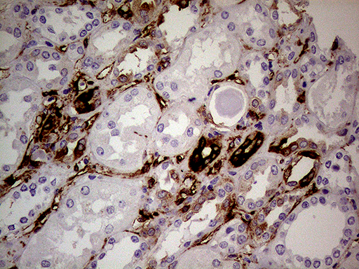 TGM2 / Transglutaminase 2 Antibody - Immunohistochemical staining of paraffin-embedded Human Kidney tissue within the normal limits using anti-TGM2 mouse monoclonal antibody. (Heat-induced epitope retrieval by 1mM EDTA in 10mM Tris buffer. (pH8.5) at 120°C for 3 min. (1:500)