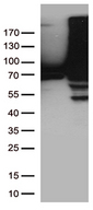 TGM2 / Transglutaminase 2 Antibody - HEK293T cells were transfected with the pCMV6-ENTRY control. (Left lane) or pCMV6-ENTRY TGM2. (Right lane) cDNA for 48 hrs and lysed