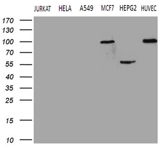 TGM2 / Transglutaminase 2 Antibody - Western blot analysis of extracts. (35ug) from 6 different cell lines by using anti-TGM2 monoclonal antibody. (1:500)