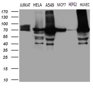 TGM2 / Transglutaminase 2 Antibody - Western blot analysis of extracts. (35ug) from 6 different cell lines by using anti-TGM2 monoclonal antibody. (1:500)