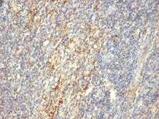 TGM2 / Transglutaminase 2 Antibody - Formalin-fixed, paraffin-embedded human tonsil stained with TGM2 antibody (SPM592).  This image was taken for the unmodified form of this product. Other forms have not been tested.