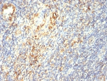 TGM2 / Transglutaminase 2 Antibody - Formalin-fixed, paraffin-embedded human tonsil stained with Transglutaminase 2 antibody (TGM2/419).  This image was taken for the unmodified form of this product. Other forms have not been tested.